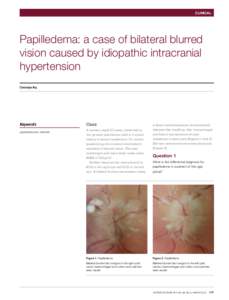 CLINICAL  Papilledema: a case of bilateral blurred vision caused by idiopathic intracranial hypertension Christolyn Raj