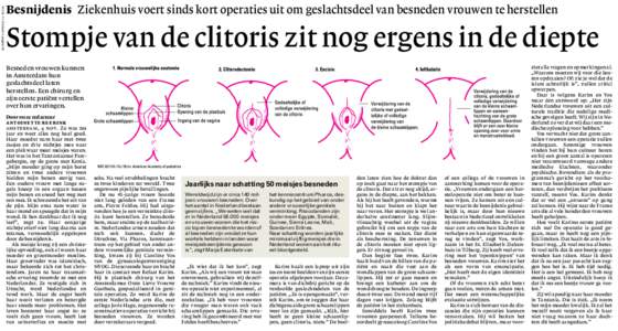 NHkatern 1 pagina 02  Besnijdenis Ziekenhuis voert sinds kort operaties uit om geslachtsdeel van besneden vrouwen te herstellen Stompje van de clitoris zit nog ergens in de diepte Besneden vrouwen kunnen