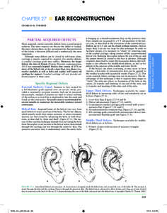 Chapter 27  n  Ear Reconstruction  Partial Acquired Defects Most acquired, partial auricular defects have a good surgical solution. The more superior on the ear the defect is located, the more choices there are for r