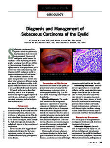 Ophthalmic Pearls ONCOLOGY Diagnosis and Management of Sebaceous Carcinoma of the Eyelid by maya s. ling, md, and rona z. silkiss, md, facs