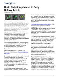 Brain Defect Implicated in Early Schizophrenia