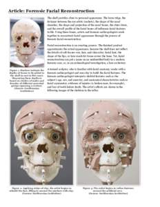 Article_ Forensic Facial Reconstruction