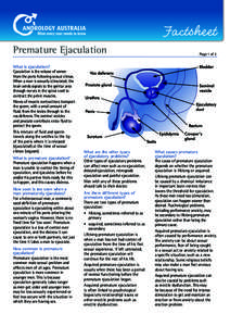 Factsheet	 Premature Ejaculation What is ejaculation? Ejaculation is the release of semen from the penis following sexual climax. When a man is sexually stimulated, the