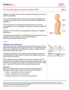 .org Cervical Spondylosis (Arthritis of the Neck) Page[removed]Neck pain is extremely common. It can be caused by many things, and is most often