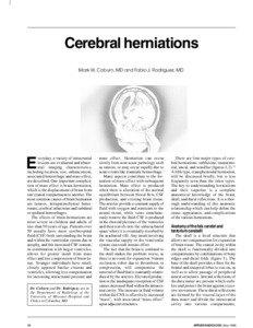 Cerebral herniations Mark W. Coburn, MD and Fabio J. Rodriguez, MD