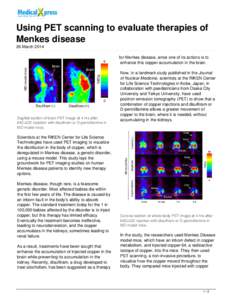 Using PET scanning to evaluate therapies of Menkes disease