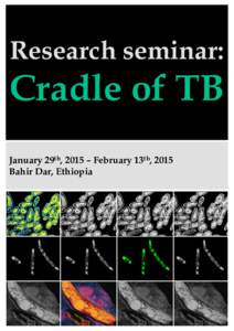Research seminar:  Cradle of TB January 29th, 2015 – February 13th, 2015 Bahir Dar, Ethiopia