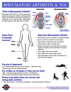 RHEUMATOID ARTHRITIS & YOU What is Rheumatoid Arthritis? Rheumatoid arthritis (RA) is a chronic (long-term) disease that causes pain, stiffness, swelling, limited motion and function of your joints most often the small j