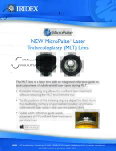 ™  NEW MicroPulse Laser Trabeculoplasty (MLT) Lens TM