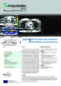 INSTITUTE FOR MEDICAL IMAGE COMPUTING  Left: Post-contrast image and Ktrans parameter map showing the tumor and healthy lung. Right: DCE-MRI scan