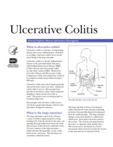 Ulcerative Colitis National Digestive Diseases Information Clearinghouse What is ulcerative colitis? Ulcerative colitis is a chronic, or long lasting, disease that causes inflammation—irritation
