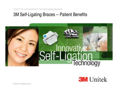 Clarity™ SL and SmartClip™ SL3 Self-Ligating Brackets