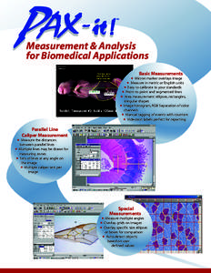 Measurement & Analysis for Biomedical Applications Basic Measurements Micron marker overlays image  Measure in metric or English units  Easy to calibrate to your standards