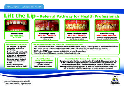 ORAL HEALTH SERVICES TASMANIA  Lift the Lip – Referral Pathway for Health Professionals Healthy teeth and gums  White lines along the gumline
