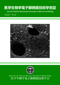 ISSN 1882 ― 160X  医学生物学電子顕微鏡技術学会誌 Journal of Electron Microscopy Technology for Med icine and Biology  Vol.25 No.2
