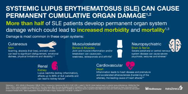 SYSTEMIC LUPUS ERYTHEMATOSUS (SLE) CAN CAUSE PERMANENT CUMULATIVE ORGAN DAMAGE1,2 More than half of SLE patients develop permanent organ system damage which could lead to increased morbidity and mortality1,3  Damage is m
