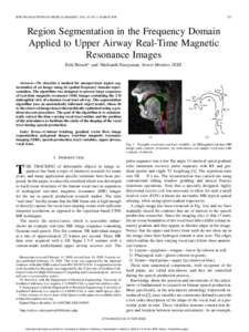 IEEE TRANSACTIONS ON MEDICAL IMAGING, VOL. 28, NO. 3, MARCHRegion Segmentation in the Frequency Domain Applied to Upper Airway Real-Time Magnetic