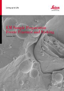 EM Sample Preparation Freeze Fracture and Etching September 2014 Plant-louse on a wheat leave