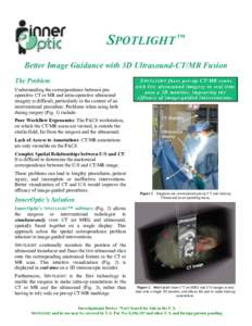 SPOTLIGHT  ™ Better Image Guidance with 3D Ultrasound-CT/MR Fusion The Problem