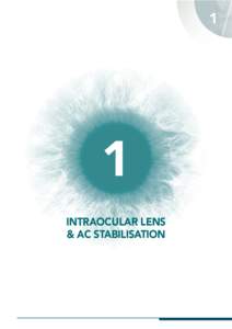 1 3 1 Intraocular Lens & AC StabilisAtion