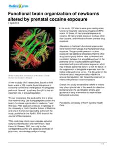 Stimulants / Cognitive neuroscience / Cocaine / Prenatal cocaine exposure / Amygdala / Connectome / Prenatal memory / Chemistry / Medicine / Neuroscience