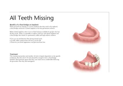 All Teeth Missing Benefits of a fixed bridge on implants When all teeth are missing or in such condition that they need to be replaced, a fixed bridge anchored to dental implants is the best permanent solution Before den