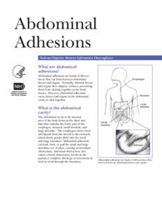 Abdominal  Adhesions National Digestive Diseases Information Clearinghouse