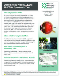 Symptomatic vitreomacular adhesion (Symptomatic VMA) What is Symptomatic VMA? As a person gets older, the central gel that fills the eye called the vitreous liquefies and loses shape, leading to separation of the vitreou