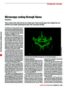 TECHNOLOGY FEATURE  Microscopy: seeing through tissue Vivien Marx  To study the causes of heart attacks, German