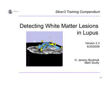 Slicer3 Training Compendium  Detecting White Matter Lesions in Lupus Version[removed]