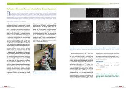 6 Imaging and Optics  PF Activity Report 2011 #29 Refraction-Contrast Tomosynthesis for a Breast Specimen