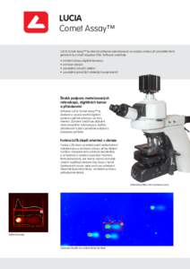 LUCIA Comet Assay™ LUCIA Comet Assay™ je výkonný software specializovaný na analýzu obrazu při provádění testů genotoxicity a studií reparace DNA. Software umožňuje: •	 snímání obrazu digitální kam