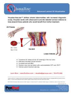 Advanced Luminal 3D Visualization Visualize:Vascular™ defines arterial abnormalities with increased diagnostic acuity. Visualize works with ultrasound to provide detailed luminal evidence to help pinpoint those patient
