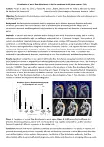 Visualisation of aortic flow disturbance in Marfan syndrome by 4D phase-contrast CMR Authors: Pitcher A, Cassar TE, Suttie J, Francis JM, Leeson P, Blair E, Wordsworth BP, Forfar JC, Myerson SG, Markl M, Neubauer SN, Pet