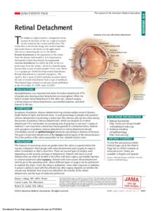 EYE DISEASES  The Journal of the American Medical Association JAMA PATIENT PAGE