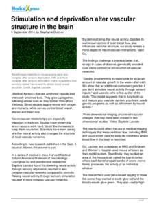 Stimulation and deprivation alter vascular structure in the brain