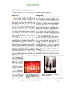 ·  . If I extract a tooth, can I use its crown as a pontic for a fixed prosthesis?