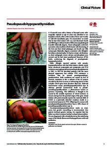 Clinical Picture  Pseudopseudohypoparathyroidism Catherine Simpson, Evan Grove, Brian A Houston A