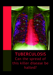 TUBERCULOSIS  Can the spread of this killer disease be halted?