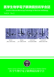 ISSN 1882 ― 160X  医学生物学電子顕微鏡技術学会誌 Journal of Electron Microscopy Technology for Med icine and Biology  Vol.24 No.2