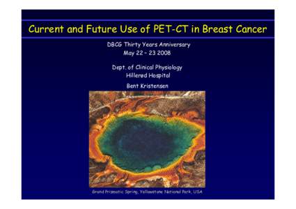 Current and Future Use of PET-CT in Breast Cancer DBCG Thirty Years Anniversary May 22 – Dept. of Clinical Physiology Hillerød Hospital Bent Kristensen