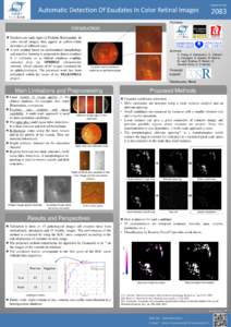Diabetes / Blindness / Diabetic retinopathy / Contrast / Exudate / Image segmentation / Optic disc / Retina