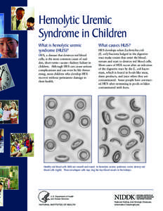 Hemolytic Uremic Syndrome in Children