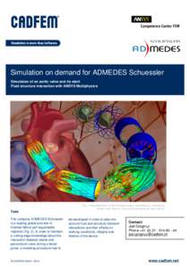 Simulation on demand for ADMEDES Schuessler Simulation of an aortic valve and its stent Fluid structure interaction with ANSYS Multiphysics a
