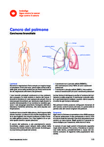 Cancro del polmone Carcinoma bronchiale laringe trachea