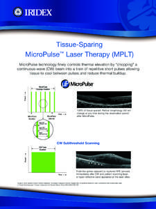 Tissue-Sparing ™ MicroPulse Laser Therapy (MPLT) CW Pulse Duration